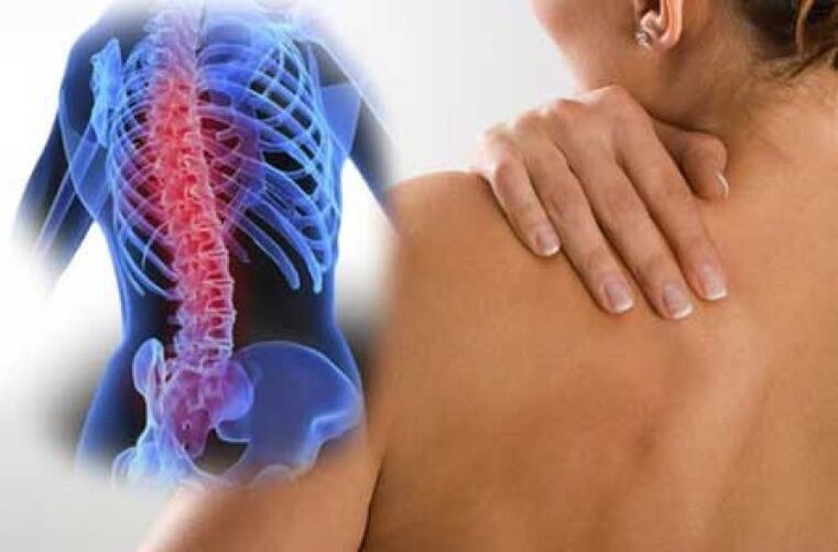 Lors d'une exacerbation de l'ostéochondrose de la colonne thoracique, des douleurs surviennent dans le dos. 