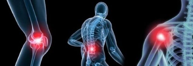 Types de douleur avec arthrose